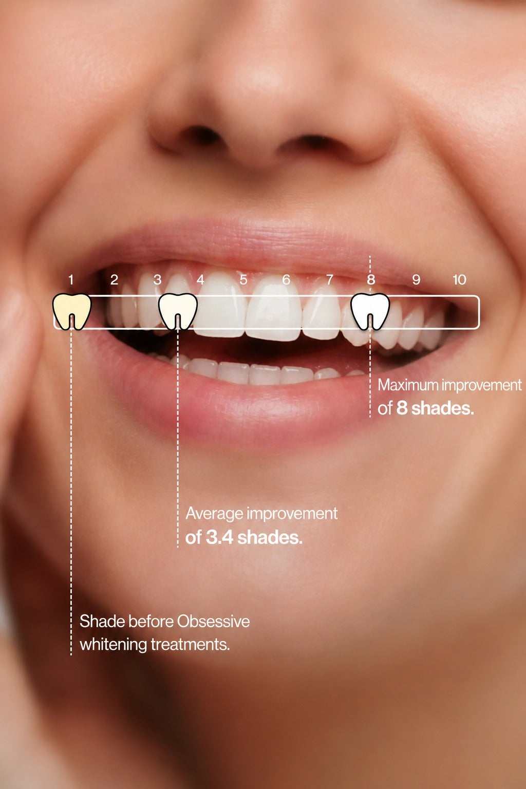 PURPLE V34 - Teeth Whitening Gel